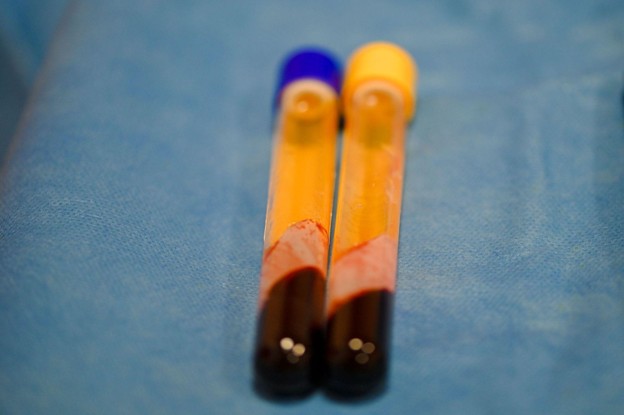 SELLAS Shares Rise, But the Trial Calls the Shots